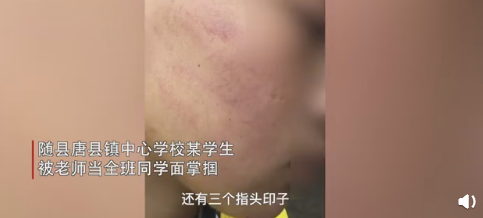 湖北学生遭老师当全班面掌掴 官方称正调查：网友吐槽快拉进黑名单